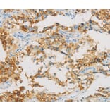 Immunohistochemistry - IDH3B Antibody from Signalway Antibody (36157) - Antibodies.com