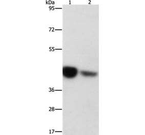 IDH3G Antibody from Signalway Antibody (36158) - Antibodies.com