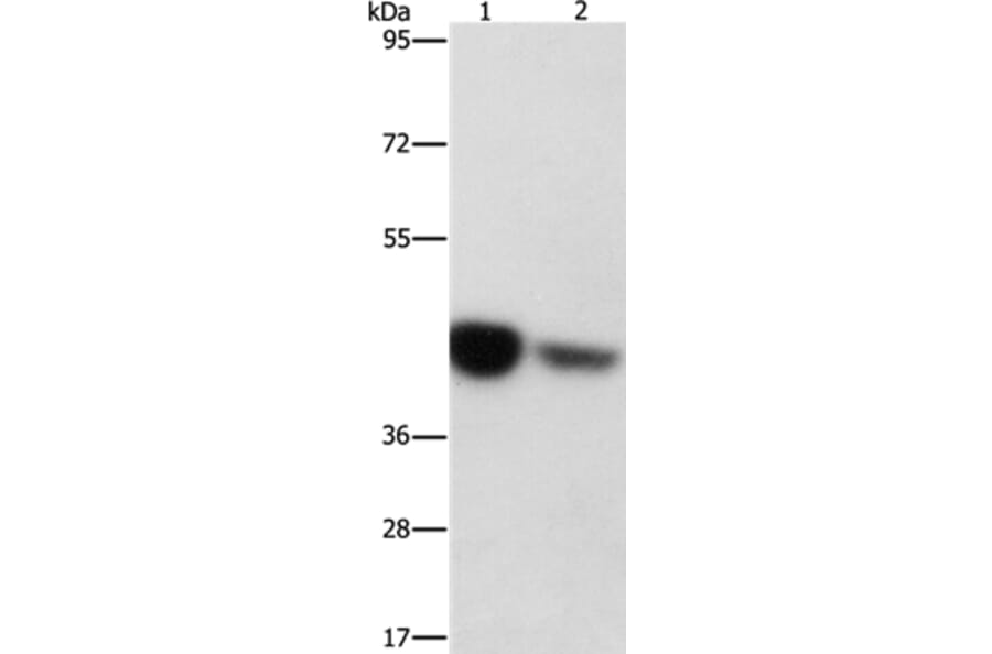 IDH3G Antibody from Signalway Antibody (36158) - Antibodies.com