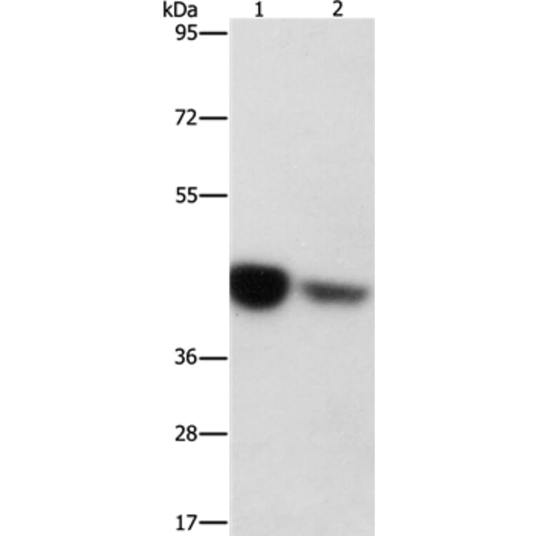 IDH3G Antibody from Signalway Antibody (36158) - Antibodies.com