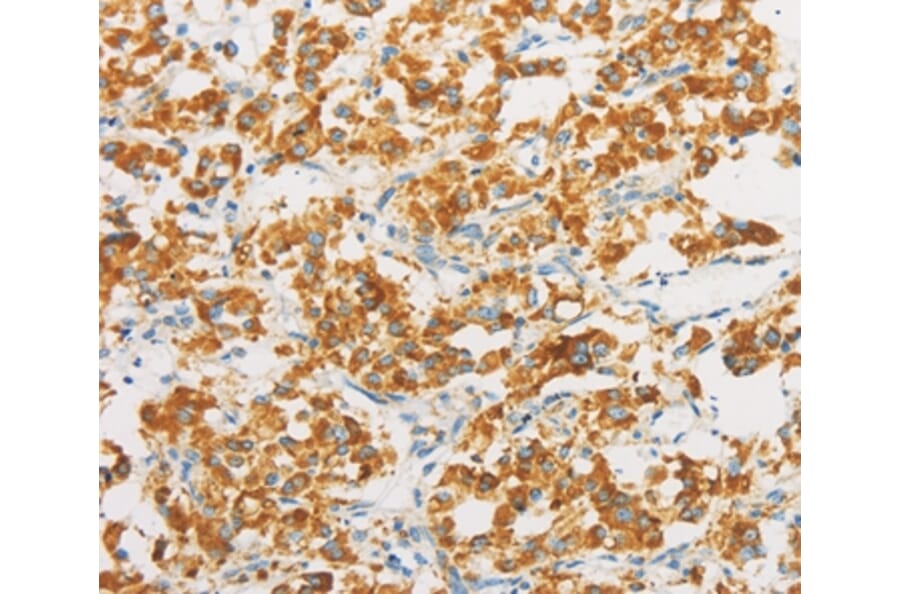 Immunohistochemistry - IDH3G Antibody from Signalway Antibody (36158) - Antibodies.com
