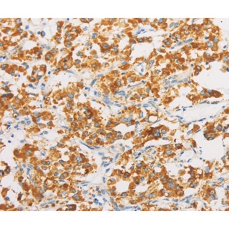 Immunohistochemistry - IDH3G Antibody from Signalway Antibody (36158) - Antibodies.com