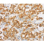 Immunohistochemistry - IDH3G Antibody from Signalway Antibody (36158) - Antibodies.com
