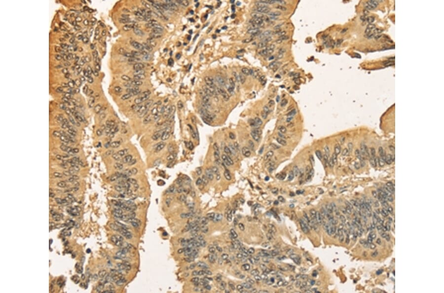 Immunohistochemistry - CDCA8 Antibody from Signalway Antibody (36163) - Antibodies.com