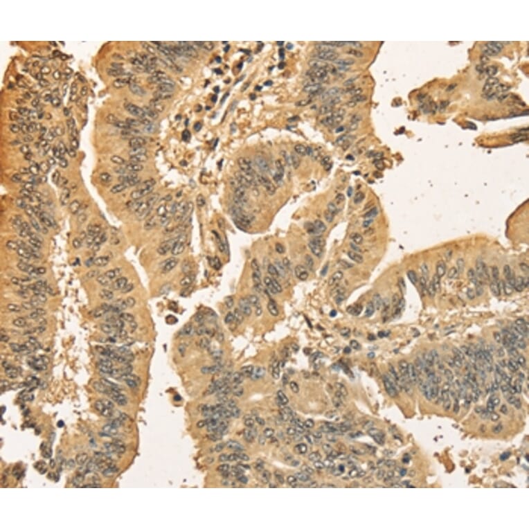 Immunohistochemistry - CDCA8 Antibody from Signalway Antibody (36163) - Antibodies.com