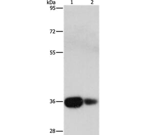 UCHL5 Antibody from Signalway Antibody (36168) - Antibodies.com