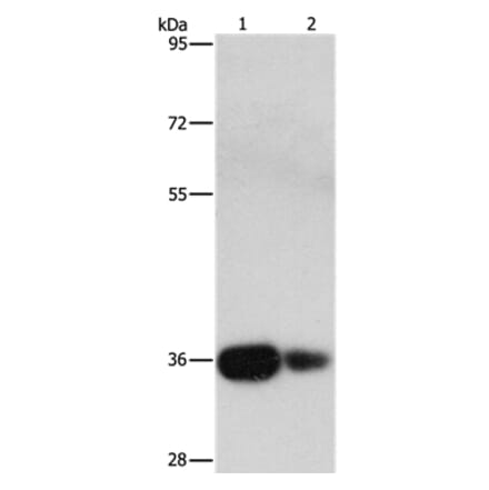 UCHL5 Antibody from Signalway Antibody (36168) - Antibodies.com