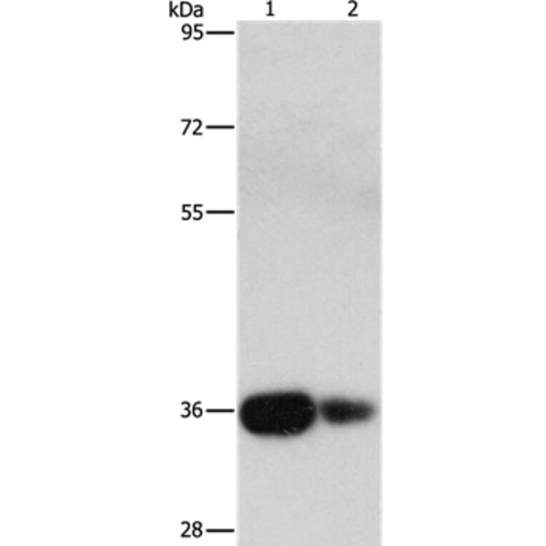 UCHL5 Antibody from Signalway Antibody (36168) - Antibodies.com
