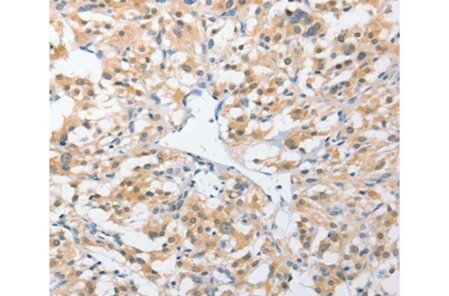 Immunohistochemistry - UCHL5 Antibody from Signalway Antibody (36168) - Antibodies.com