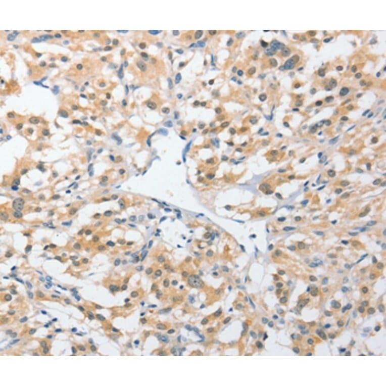 Immunohistochemistry - UCHL5 Antibody from Signalway Antibody (36168) - Antibodies.com