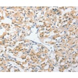 Immunohistochemistry - UCHL5 Antibody from Signalway Antibody (36168) - Antibodies.com