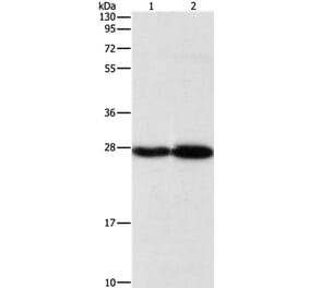 PSMB7 Antibody from Signalway Antibody (36179) - Antibodies.com