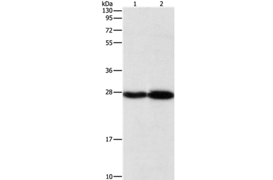 PSMB7 Antibody from Signalway Antibody (36179) - Antibodies.com