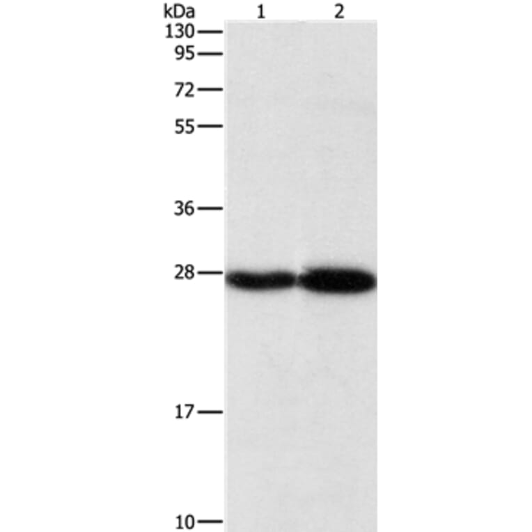 PSMB7 Antibody from Signalway Antibody (36179) - Antibodies.com