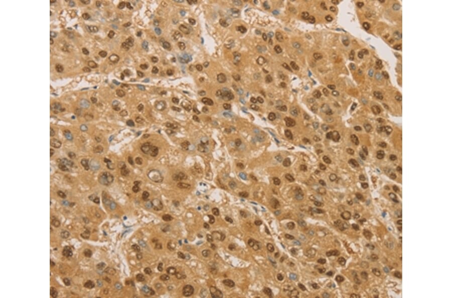 Immunohistochemistry - PSMB7 Antibody from Signalway Antibody (36179) - Antibodies.com
