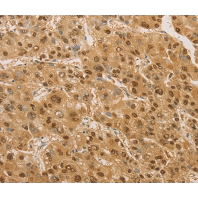 Immunohistochemistry - PSMB7 Antibody from Signalway Antibody (36179) - Antibodies.com