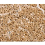 Immunohistochemistry - PSMB7 Antibody from Signalway Antibody (36179) - Antibodies.com