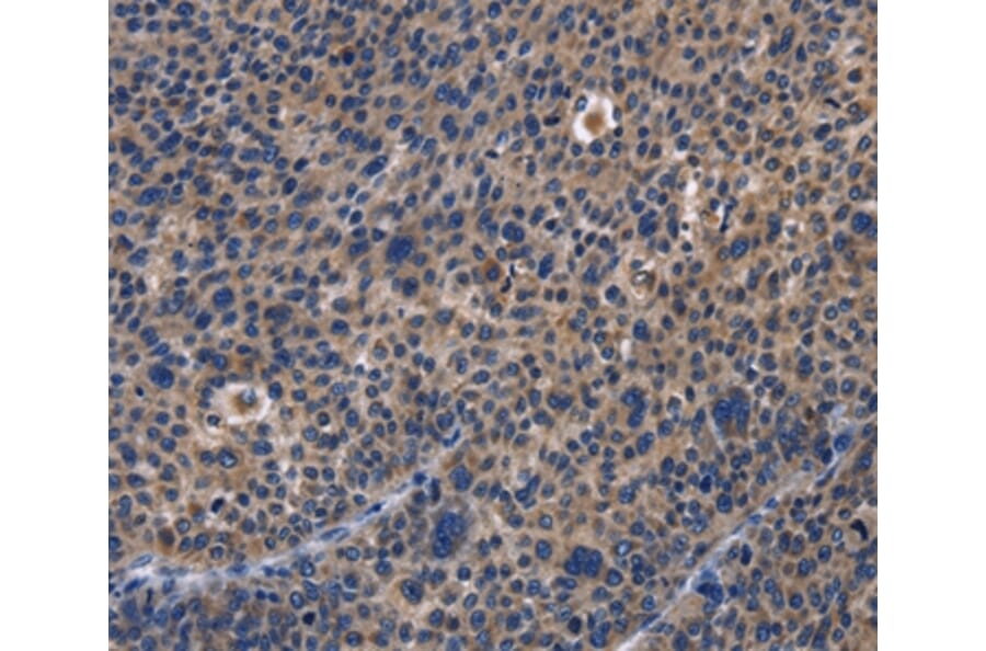 Immunohistochemistry - PRKCD Antibody from Signalway Antibody (36186) - Antibodies.com