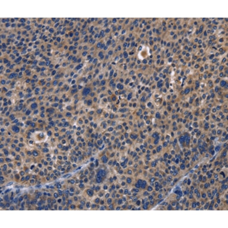 Immunohistochemistry - PRKCD Antibody from Signalway Antibody (36186) - Antibodies.com