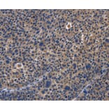 Immunohistochemistry - PRKCD Antibody from Signalway Antibody (36186) - Antibodies.com
