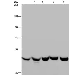 YARS2 Antibody from Signalway Antibody (36199) - Antibodies.com
