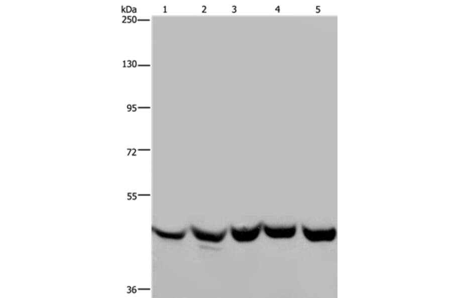 YARS2 Antibody from Signalway Antibody (36199) - Antibodies.com