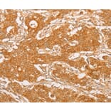 Immunohistochemistry - YARS2 Antibody from Signalway Antibody (36199) - Antibodies.com