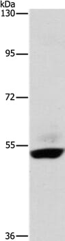 Gel: 6%SDS-PAGE Lysates (from left to right): Human placenta tissue Amount of lysate: 40ug per lane Primary antibody: 1/400 dilution Secondary antibody dilution: 1/8000 Exposure time: 2 minutes