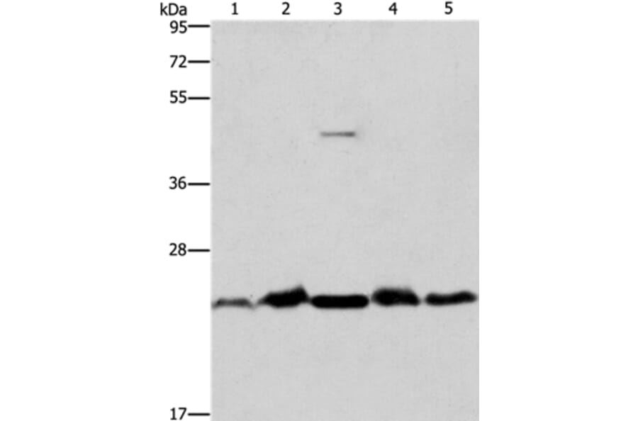 THOC7 Antibody from Signalway Antibody (36221) - Antibodies.com