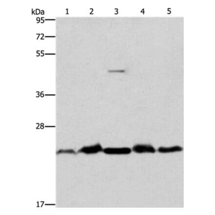 THOC7 Antibody from Signalway Antibody (36221) - Antibodies.com