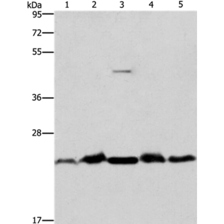 THOC7 Antibody from Signalway Antibody (36221) - Antibodies.com