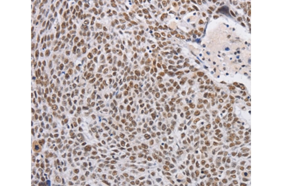 Immunohistochemistry - THOC7 Antibody from Signalway Antibody (36221) - Antibodies.com