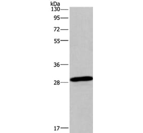 BNIP3 Antibody from Signalway Antibody (36224) - Antibodies.com