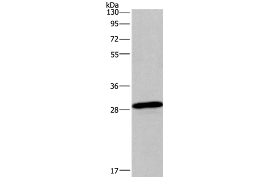 BNIP3 Antibody from Signalway Antibody (36224) - Antibodies.com