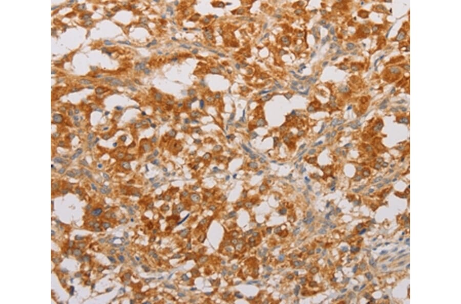Immunohistochemistry - BNIP3 Antibody from Signalway Antibody (36224) - Antibodies.com