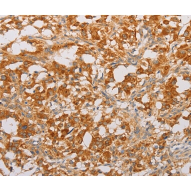 Immunohistochemistry - BNIP3 Antibody from Signalway Antibody (36224) - Antibodies.com