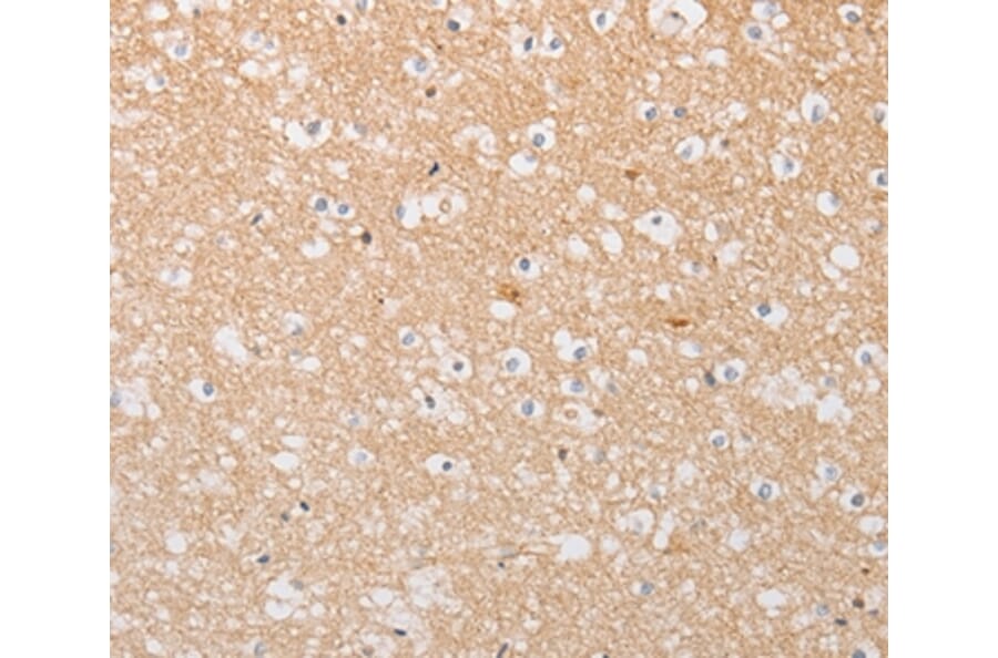 Immunohistochemistry - ATG9A Antibody from Signalway Antibody (36225) - Antibodies.com