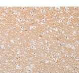 Immunohistochemistry - ATG9A Antibody from Signalway Antibody (36225) - Antibodies.com