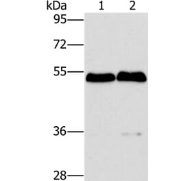 SPHK2 Antibody from Signalway Antibody (36238) - Antibodies.com
