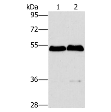 SPHK2 Antibody from Signalway Antibody (36238) - Antibodies.com