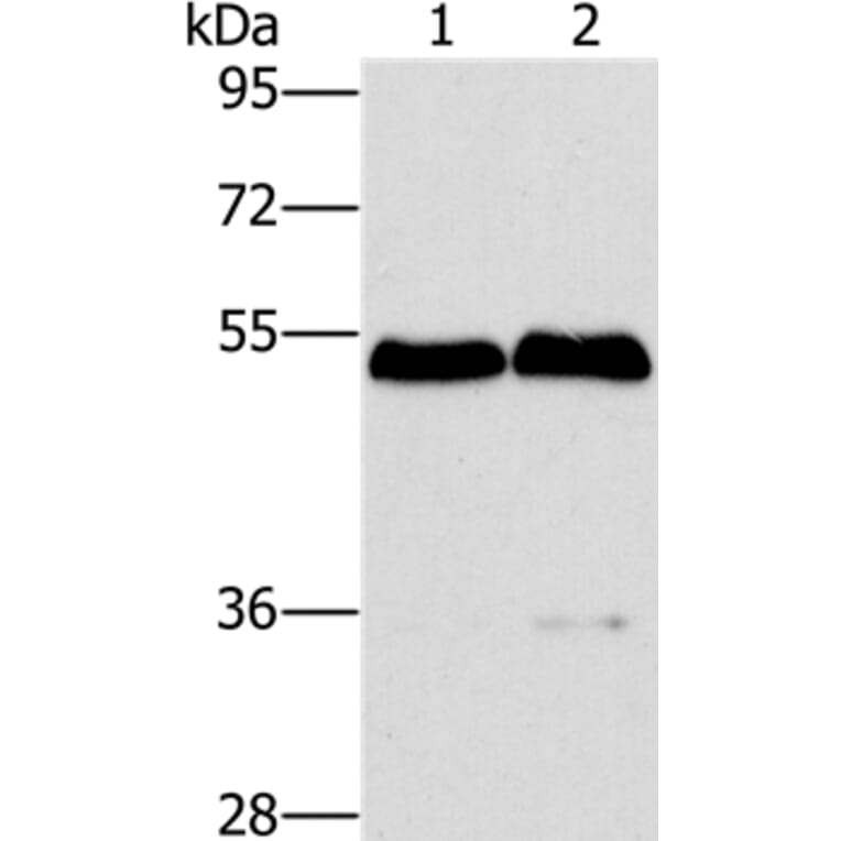 SPHK2 Antibody from Signalway Antibody (36238) - Antibodies.com