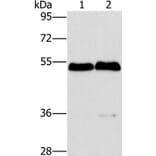 SPHK2 Antibody from Signalway Antibody (36238) - Antibodies.com