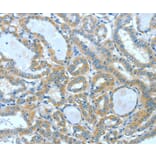 Immunohistochemistry - SPHK2 Antibody from Signalway Antibody (36238) - Antibodies.com