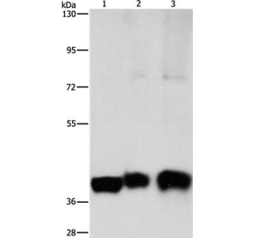 ASAH1 Antibody from Signalway Antibody (36239) - Antibodies.com