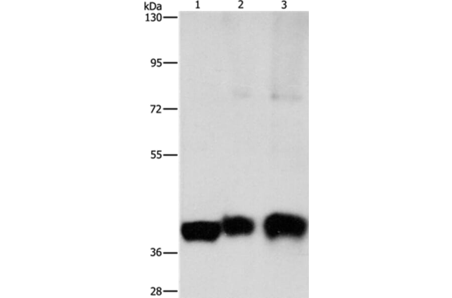 ASAH1 Antibody from Signalway Antibody (36239) - Antibodies.com