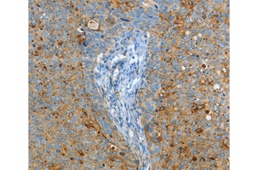 Immunohistochemistry - ASAH1 Antibody from Signalway Antibody (36239) - Antibodies.com