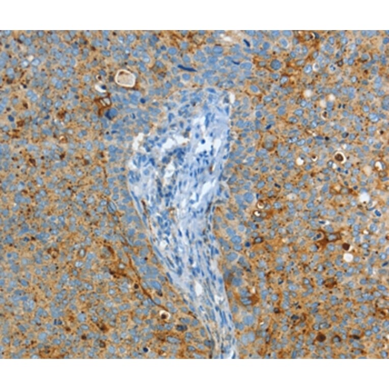 Immunohistochemistry - ASAH1 Antibody from Signalway Antibody (36239) - Antibodies.com