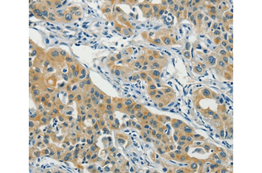 Immunohistochemistry - ASAH2 Antibody from Signalway Antibody (36240) - Antibodies.com