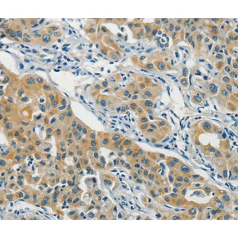 Immunohistochemistry - ASAH2 Antibody from Signalway Antibody (36240) - Antibodies.com