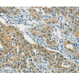 Immunohistochemistry - ASAH2 Antibody from Signalway Antibody (36240) - Antibodies.com